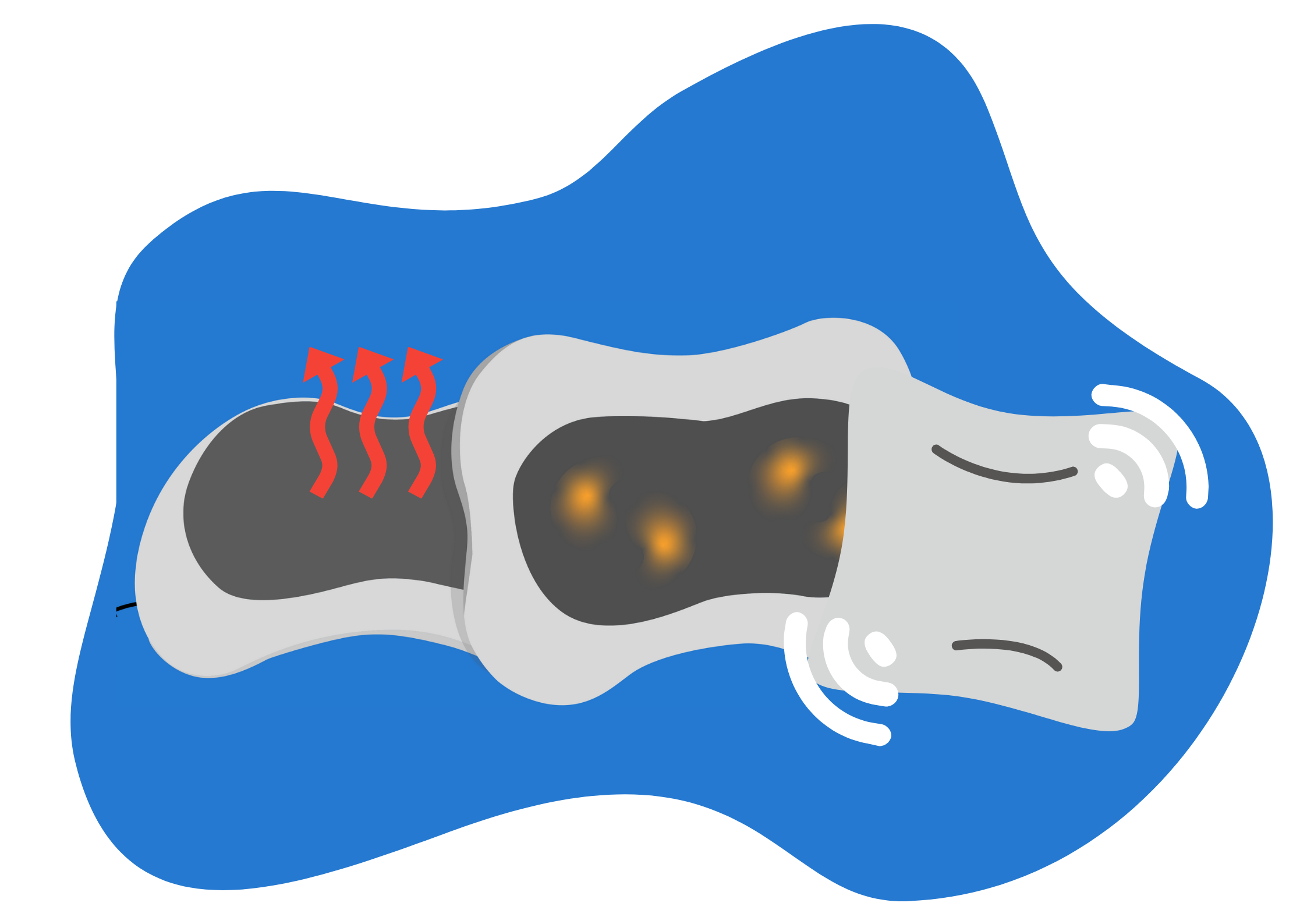 types de coussins massant